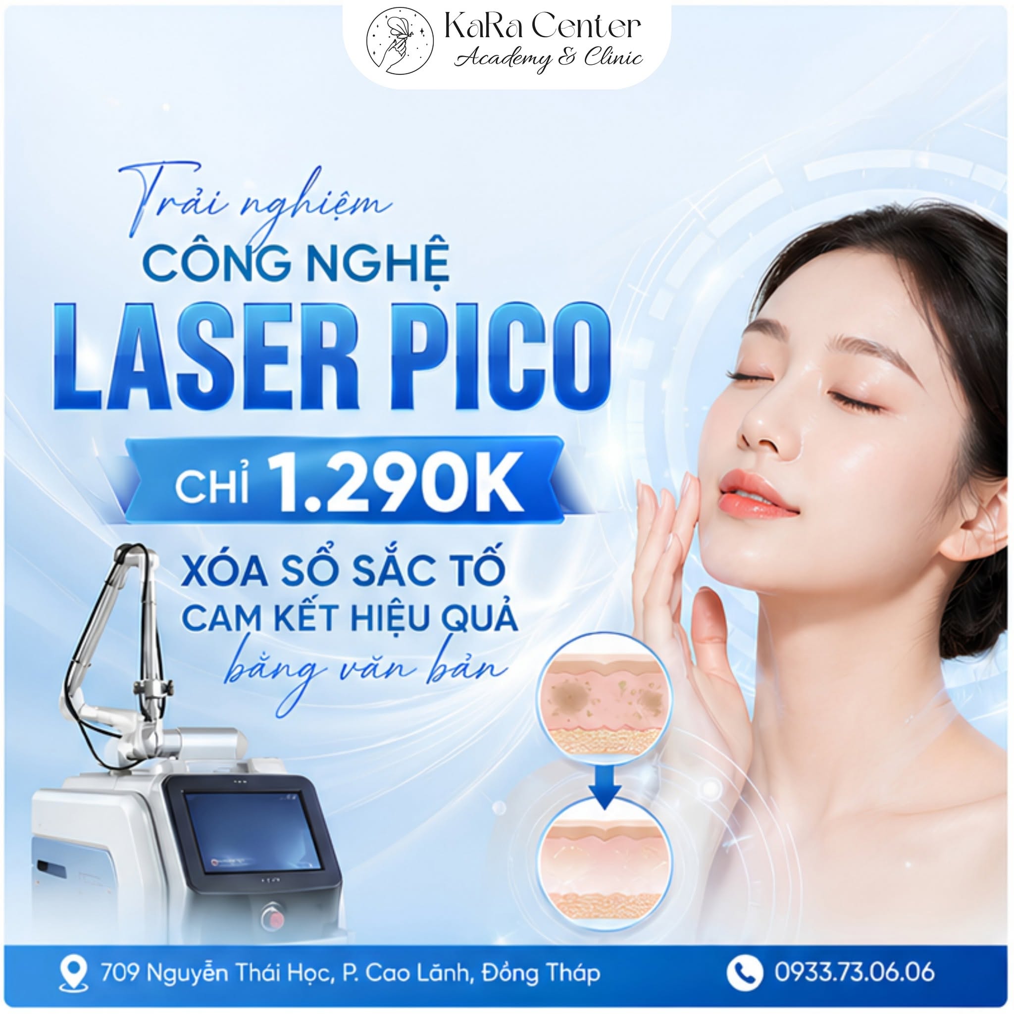 Điều Trị Nám Tại Cao Lãnh Bằng Laser Pico Chỉ 1.290K