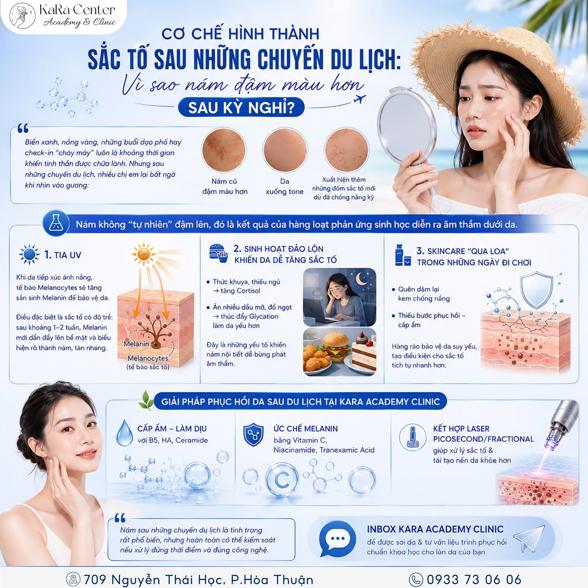 Nám da sau đi biển đậm màu hơn do tác động của tia UV